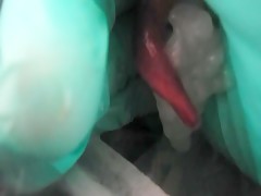 Thumb 2